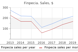 order 1 mg finpecia amex