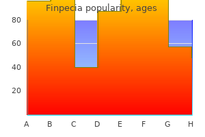 buy finpecia 1mg on-line