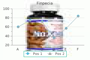 finpecia 1 mg line