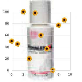 Chromosome 3, monosomy 3q13