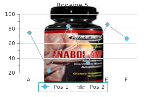 safe rogaine 5 60ml