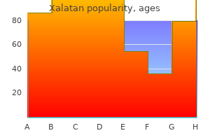 buy xalatan 2.5ml cheap
